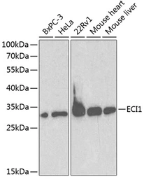 Anti-DCI antibody used in Western Blot (WB). GTX53991