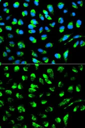 Anti-DCI antibody used in Immunocytochemistry/ Immunofluorescence (ICC/IF). GTX53991