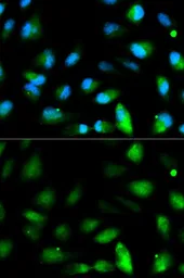 Anti-JAM-A antibody used in Immunocytochemistry/ Immunofluorescence (ICC/IF). GTX53992