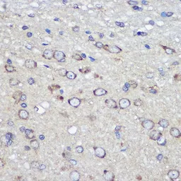 Anti-JAM-A antibody used in IHC (Paraffin sections) (IHC-P). GTX53992