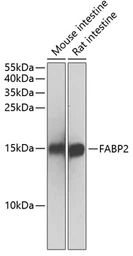 Anti-FABP2 antibody used in Western Blot (WB). GTX53994