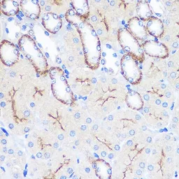 Anti-CD64 antibody used in IHC (Paraffin sections) (IHC-P). GTX53995