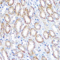 Anti-CD64 antibody used in IHC (Paraffin sections) (IHC-P). GTX53995