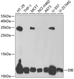 Anti-DBI antibody used in Western Blot (WB). GTX53999