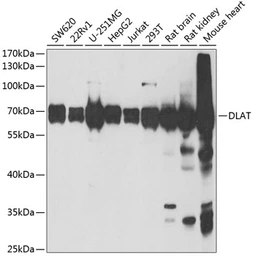 Anti-DLAT antibody used in Western Blot (WB). GTX54002