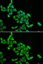 Anti-DLAT antibody used in Immunocytochemistry/ Immunofluorescence (ICC/IF). GTX54002