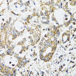 Anti-EPB41 antibody used in IHC (Paraffin sections) (IHC-P). GTX54005