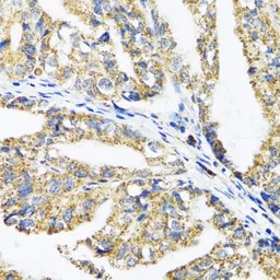 Anti-EPB41 antibody used in IHC (Paraffin sections) (IHC-P). GTX54005