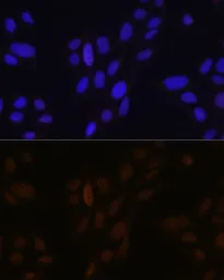 Anti-PEA3 antibody used in Immunocytochemistry/ Immunofluorescence (ICC/IF). GTX54006
