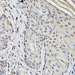 Anti-PEA3 antibody used in IHC (Paraffin sections) (IHC-P). GTX54006