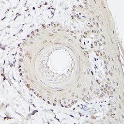 Anti-PEA3 antibody used in IHC (Paraffin sections) (IHC-P). GTX54006