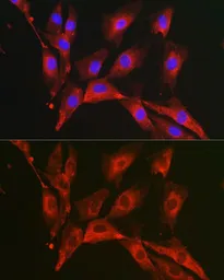 Anti-FBP1 antibody used in Immunocytochemistry/ Immunofluorescence (ICC/IF). GTX54007