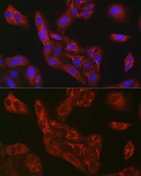 Anti-FBP1 antibody used in Immunocytochemistry/ Immunofluorescence (ICC/IF). GTX54007