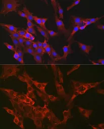 Anti-FBP1 antibody used in Immunocytochemistry/ Immunofluorescence (ICC/IF). GTX54007