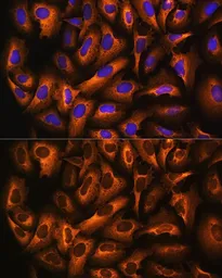 Anti-eEF1A1 antibody used in Immunocytochemistry/ Immunofluorescence (ICC/IF). GTX54012