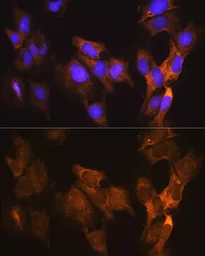 Anti-eEF1A1 antibody used in Immunocytochemistry/ Immunofluorescence (ICC/IF). GTX54012