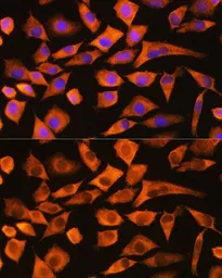 Anti-eEF1A1 antibody used in Immunocytochemistry/ Immunofluorescence (ICC/IF). GTX54012