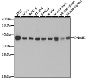 Anti-Hsp40 antibody used in Western Blot (WB). GTX54013