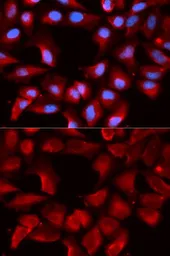 Anti-Hsp40 antibody used in Immunocytochemistry/ Immunofluorescence (ICC/IF). GTX54013