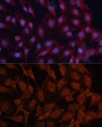 Anti-Hsp40 antibody used in Immunocytochemistry/ Immunofluorescence (ICC/IF). GTX54013