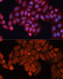 Anti-Hsp40 antibody used in Immunocytochemistry/ Immunofluorescence (ICC/IF). GTX54013