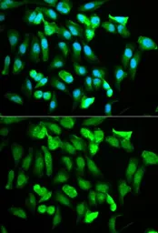 Anti-ERG antibody used in Immunocytochemistry/ Immunofluorescence (ICC/IF). GTX54015