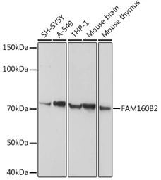 Anti-RAI16 antibody used in Western Blot (WB). GTX54018