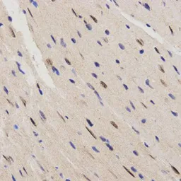 Anti-RAI16 antibody used in IHC (Paraffin sections) (IHC-P). GTX54018