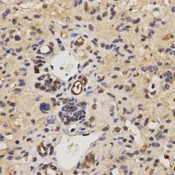 Anti-RAI16 antibody used in IHC (Paraffin sections) (IHC-P). GTX54018