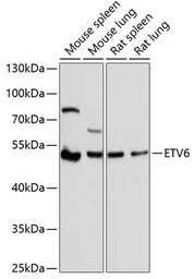 Anti-TEL antibody used in Western Blot (WB). GTX54020
