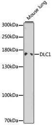 Anti-DLC1 antibody used in Western Blot (WB). GTX54022