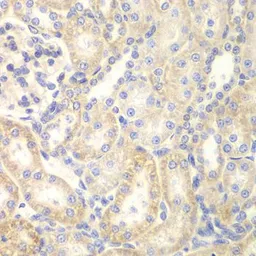 Anti-DLC1 antibody used in IHC (Paraffin sections) (IHC-P). GTX54022
