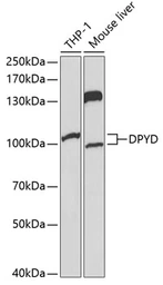 Anti-DPYD antibody used in Western Blot (WB). GTX54023