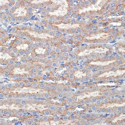 Anti-Flotillin 1 antibody used in IHC (Paraffin sections) (IHC-P). GTX54027