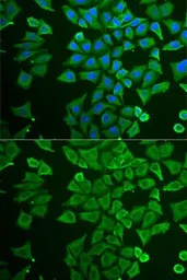 Anti-DDAH2 antibody used in Immunocytochemistry/ Immunofluorescence (ICC/IF). GTX54028