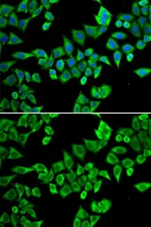 Anti-Gemin 3 antibody used in Immunocytochemistry/ Immunofluorescence (ICC/IF). GTX54029