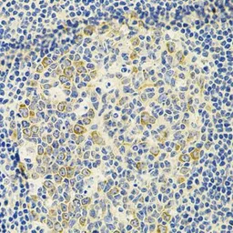 Anti-Gemin 3 antibody used in IHC (Paraffin sections) (IHC-P). GTX54029