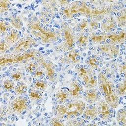 Anti-Gemin 3 antibody used in IHC (Paraffin sections) (IHC-P). GTX54029