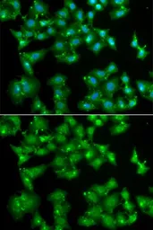Anti-ESE1 antibody used in Immunocytochemistry/ Immunofluorescence (ICC/IF). GTX54033