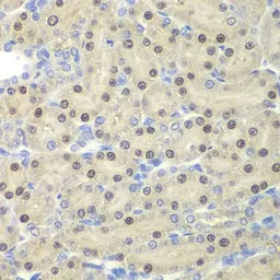 Anti-ESE1 antibody used in IHC (Paraffin sections) (IHC-P). GTX54033