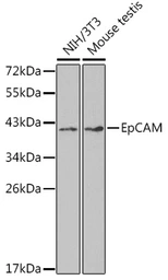 Anti-EpCAM antibody used in Western Blot (WB). GTX54034