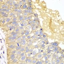 Anti-EpCAM antibody used in IHC (Paraffin sections) (IHC-P). GTX54034
