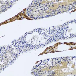 Anti-Fibromodulin antibody used in IHC (Paraffin sections) (IHC-P). GTX54035