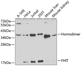 Anti-FHIT antibody used in Western Blot (WB). GTX54037