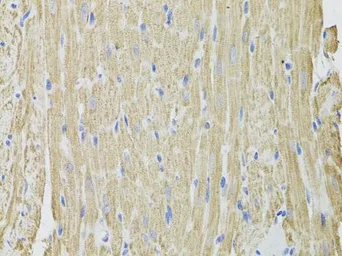 Anti-FHIT antibody used in IHC (Paraffin sections) (IHC-P). GTX54037