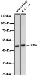 Anti-DDB2 antibody used in Western Blot (WB). GTX54039