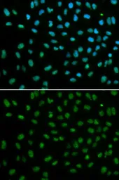 Anti-DDB2 antibody used in Immunocytochemistry/ Immunofluorescence (ICC/IF). GTX54039