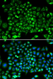 Anti-DRP1 antibody used in Immunocytochemistry/ Immunofluorescence (ICC/IF). GTX54040