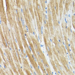 Anti-DRP1 antibody used in IHC (Paraffin sections) (IHC-P). GTX54040