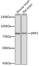 Anti-DRP1 antibody used in Western Blot (WB). GTX54040